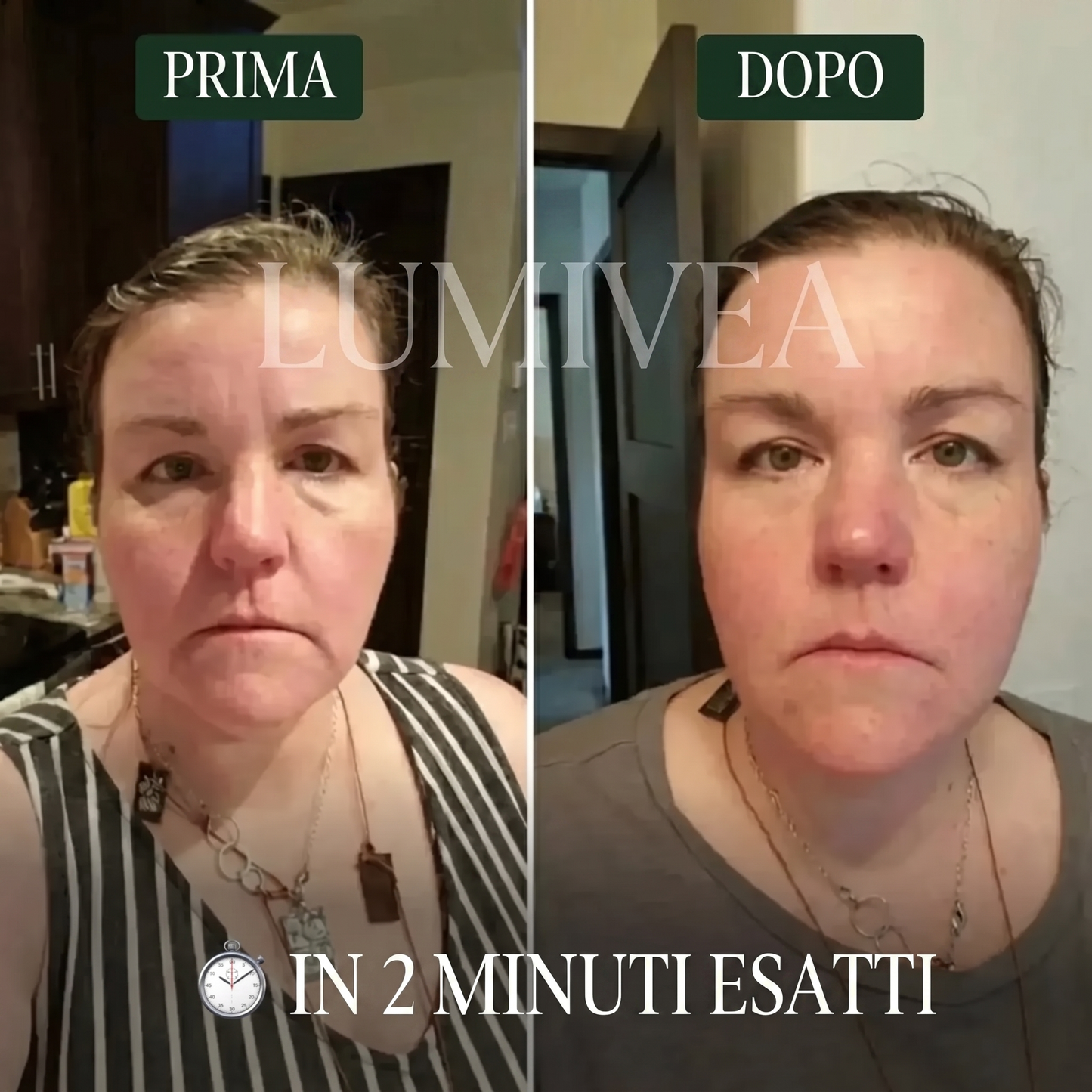 Spazzola Linfatica Viso Lumivea