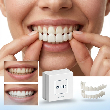 Faccette Dentali Smilavea